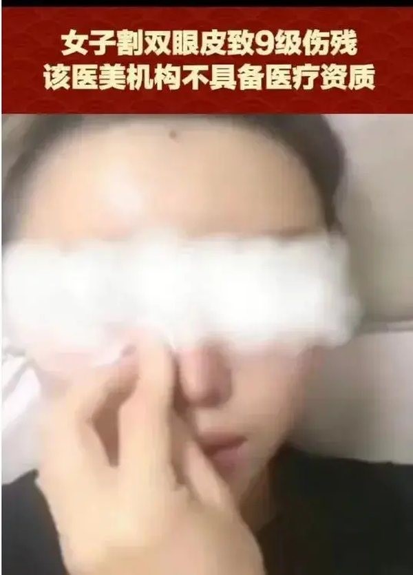 女子做双眼皮手术遭遇失败，无证美容机构被罚百万